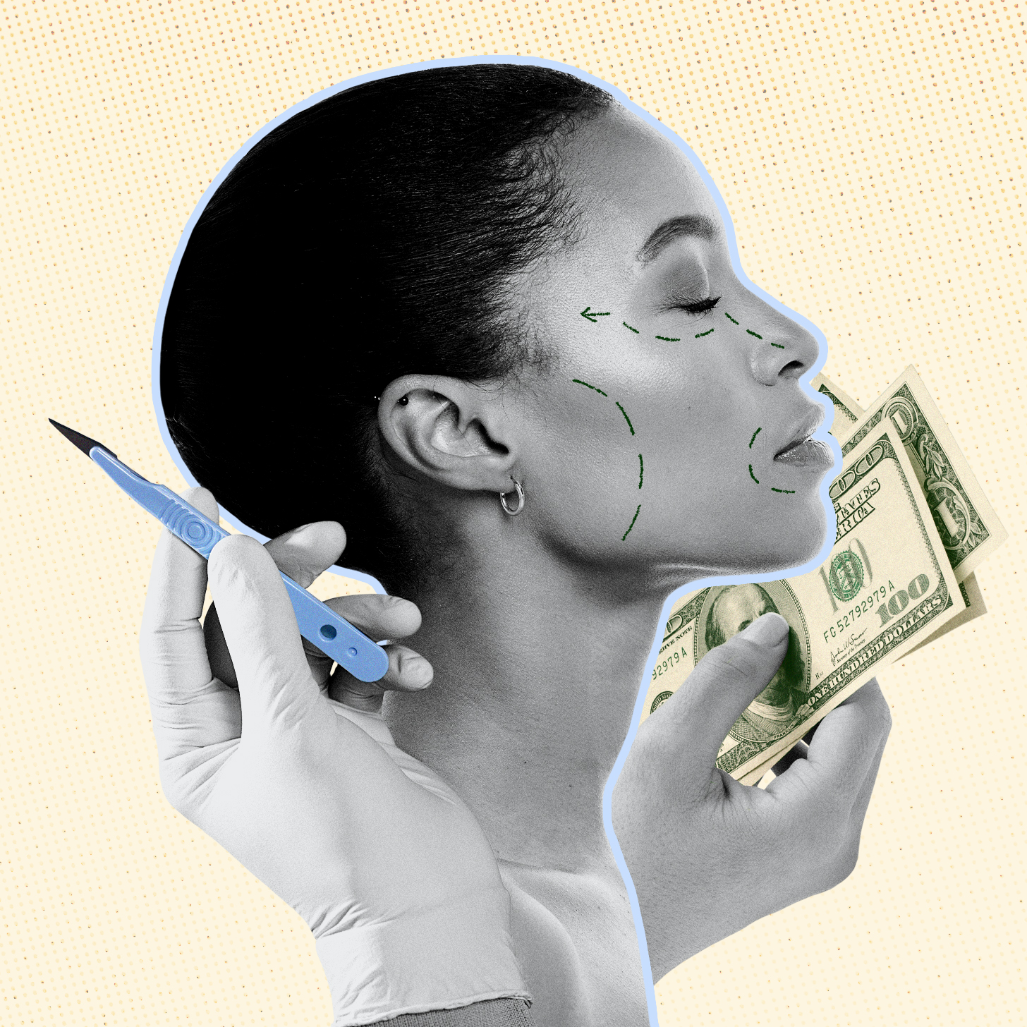 Just How Risky Are “Buy Now, Pay Later” Plastic Surgery Payment Plans?