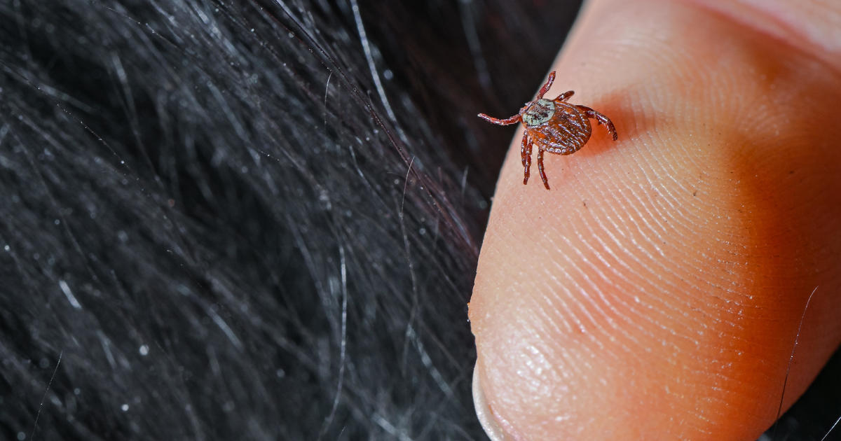 How hunters are helping researchers track the spread of tick-borne diseases