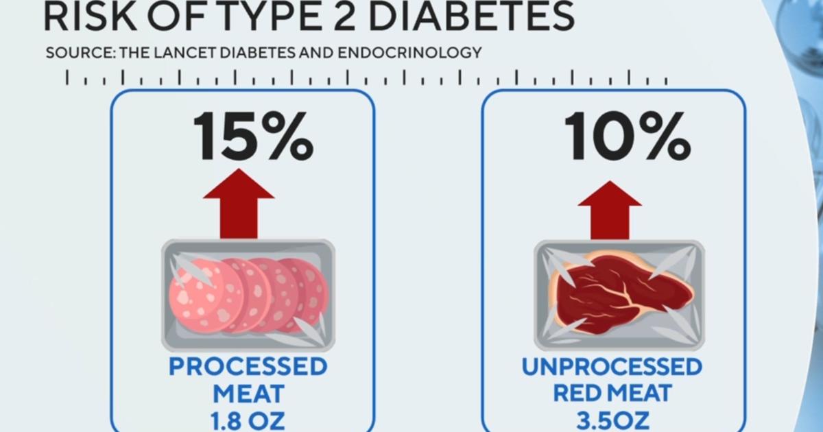 Processed and red meat increases risk for type 2 diabetes, study finds